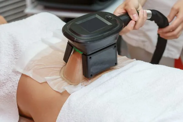 Image of person having fat freezing treatment to help weight gain Hythe