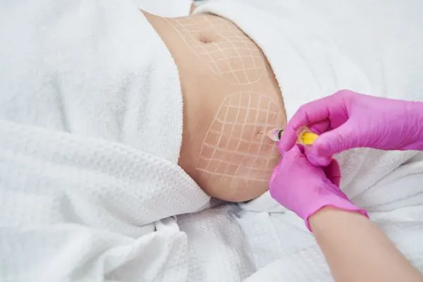 image of fat dissolving injections on love handles to help combat weight gain Hythe